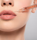 Lippenaufbau mit 1 ml Hyaluron